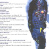 Iron Maiden - High Vaultage Vol. 2  ( Westwood One Rare Recordings )
